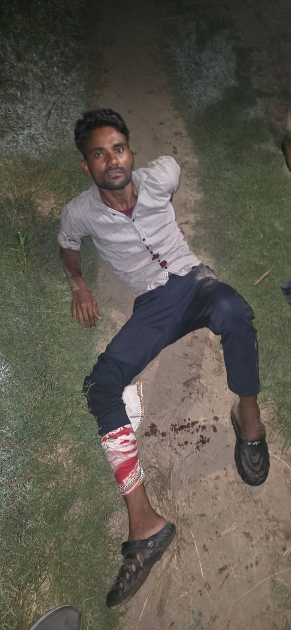 गाजियाबाद में पुलिस व बदमाशों में तीन जगह चली गोलियां,पांच बदमाश हुए लंगड़े