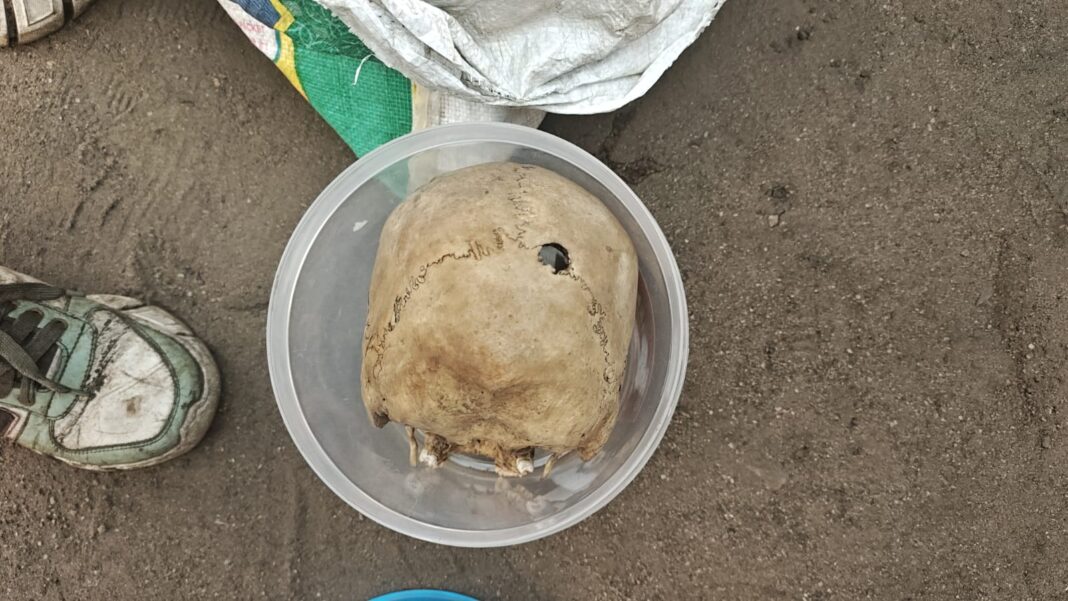 रामगढ़ हत्याकांड: सोनू राम को सिर के पीछे गोली मारी गई, खोपड़ी मिलने से बड़ा खुलासा