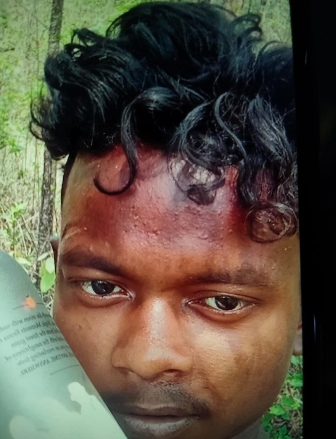 पश्चिम सिंहभूम में भीषण सड़क हादसा: दो युवकों की मौत, एक की हालत गंभीर पश्चिम सिंहभूम में भीषण सड़क हादसा: दो युवकों की मौत, एक की हालत गंभीर