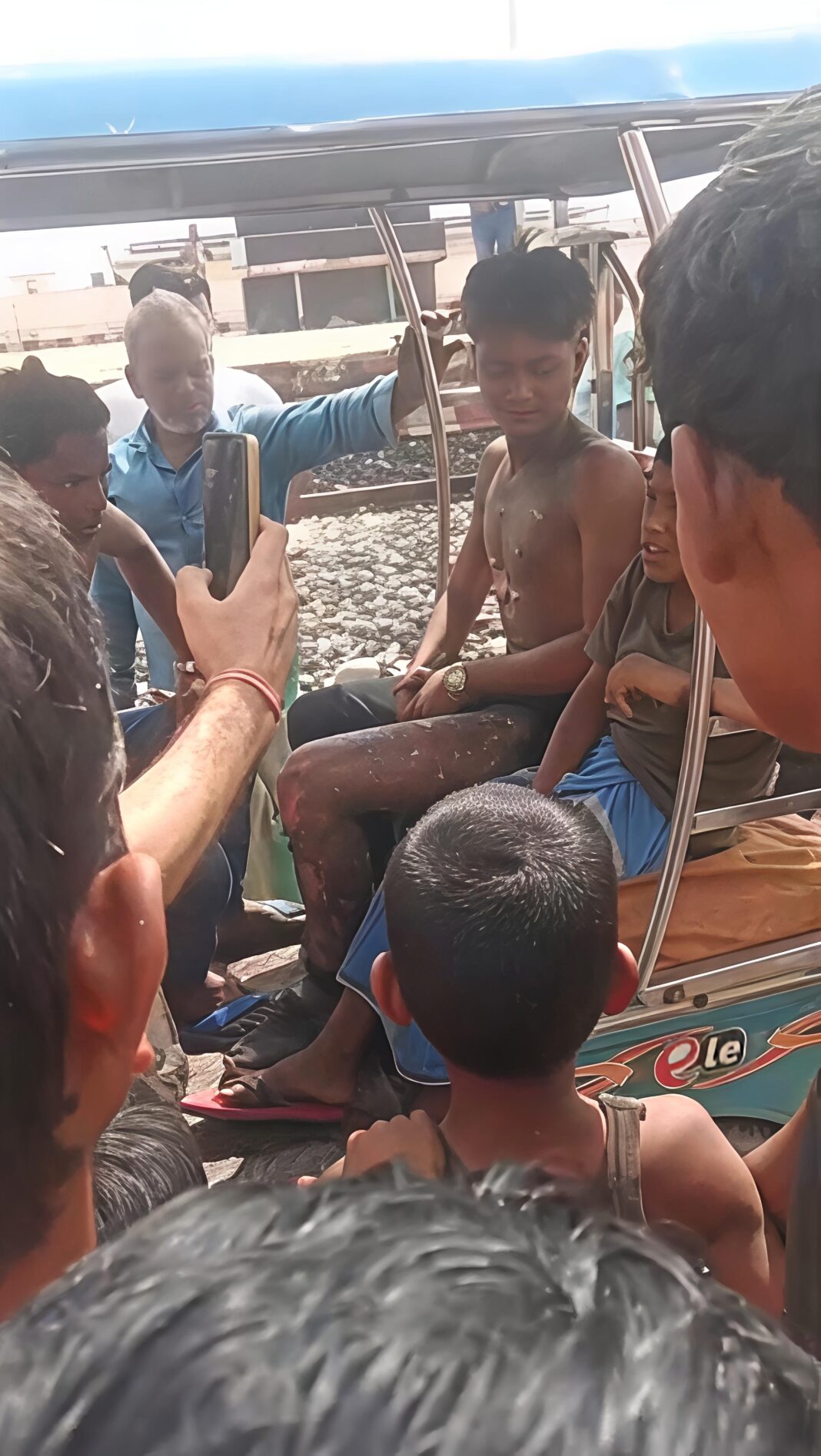 रील बनाने का खतरनाक ट्रेंड! हाई वोल्टेज तार की चपेट में आए युवक और बच्चा, हालत गंभीर रील बनाने का खतरनाक ट्रेंड! हाई वोल्टेज तार की चपेट में आए युवक और बच्चा, हालत गंभीर