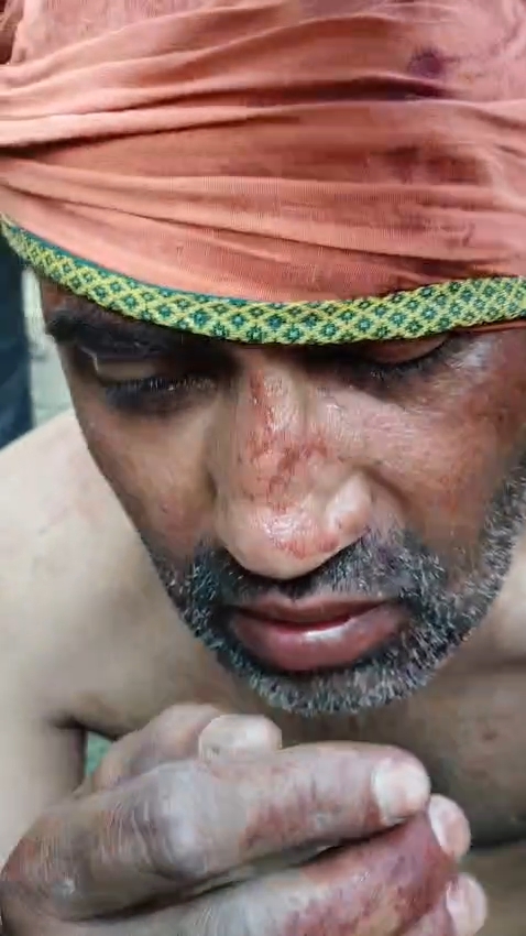 चंदौली अस्पताल में महिला की गोली मारकर हत्या, भागते आरोपी को लोगों ने पकड़ा चंदौली अस्पताल में महिला की गोली मारकर हत्या, भागते आरोपी को लोगों ने पकड़ा