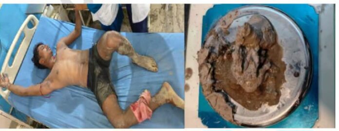 पुलिस मुठभेड़ में घायल ड्रग्स तस्कर