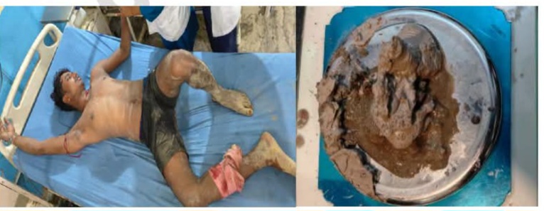 पुलिस मुठभेड़ में घायल हुआ भारतीय ड्रग्स तस्कर पुलिस मुठभेड़ में घायल ड्रग्स तस्कर