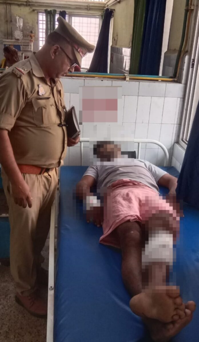 पुलिस मुठभेड़ में घायल अपराधी