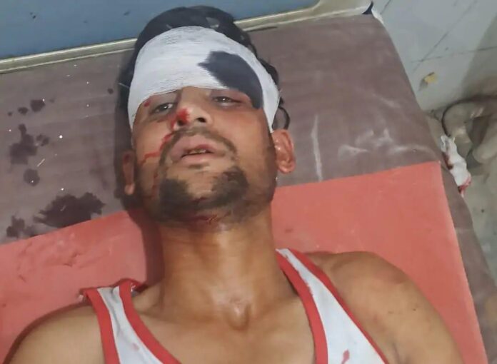 ट्रक टक्कर में युवक घायल हो गया