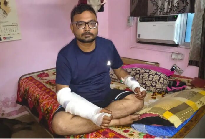 अशीम बनर्जी घायल का दुखद दृश्य