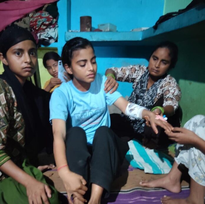 बंदरों के हमले में किशोरी