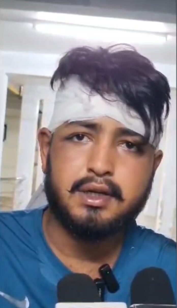 अभिषेक गिरी घायल हादसा बॉलीवुड अभिनेता अभिषेक गिरी घायल हादसा बॉलीवुड अभिनेता