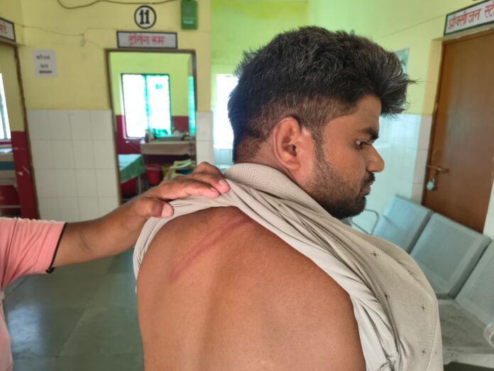 पुलिस पिटाई से घायल युवक
