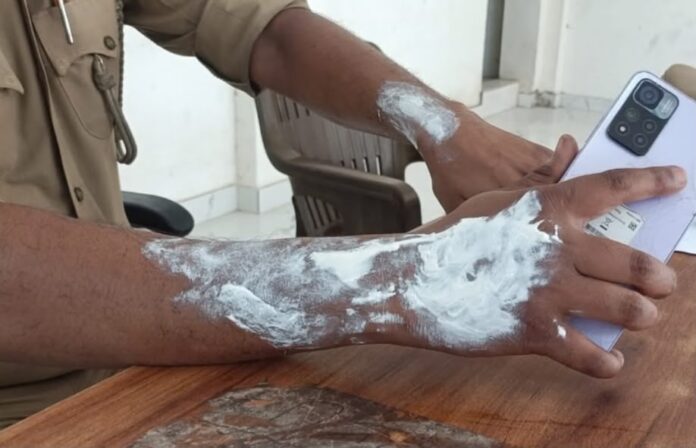 पुलिसकर्मी झुलसा वीडियो