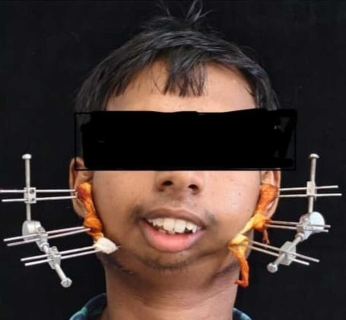अमली कापा निवासी 24 वर्षीय युवक का कारनामा अमली कापा निवासी 24 वर्षीय युवक का कारनामा