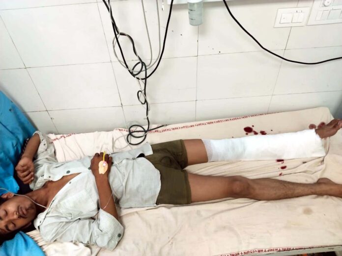 पुलिस गोली से घायल बदमाश की तस्वीर