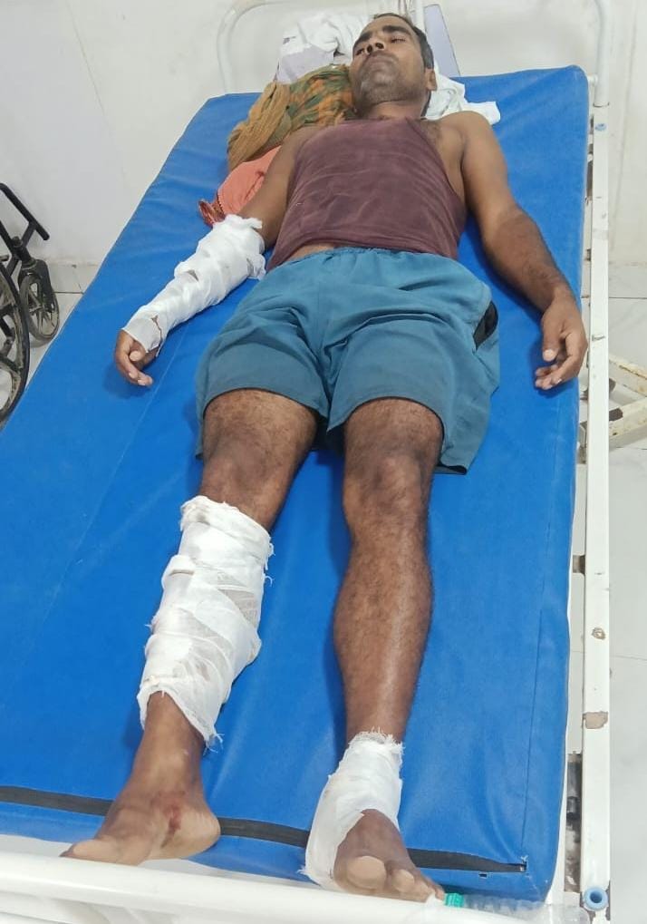 घायल छोटन यादव घायल छोटन यादव